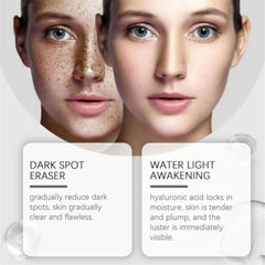 Dark Spot Corrector Serum - Face & Hand Pigmentation Repair Lotion (30ml)