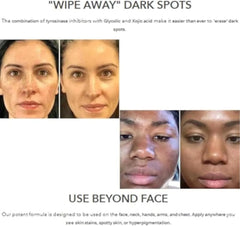 Dark Spot Corrector Serum - Face & Hand Pigmentation Repair Lotion (30ml)