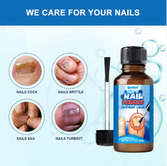 Sumifun - Nail Fungus Treatment Liquid | سوميفون - سائل علاج فطريات الأظافر